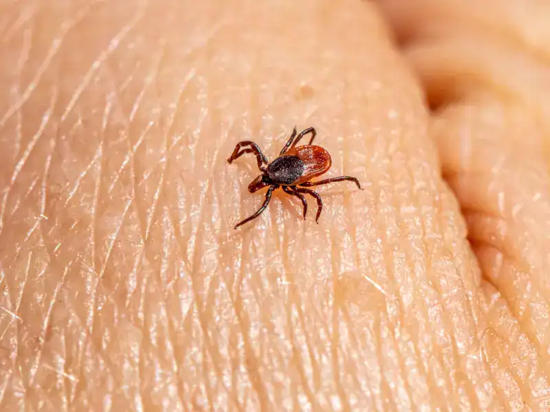 Close-up of a flea on human skin in Cornwall